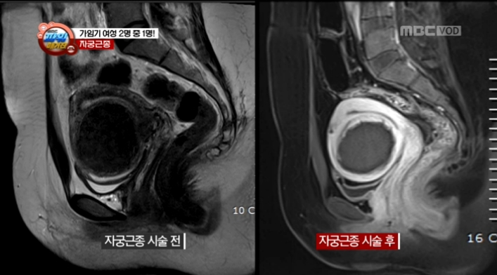 캡처_2015_01_09_12_23_42_18.jpg